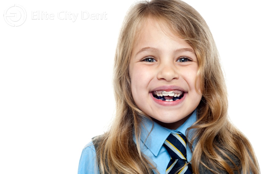 Care sunt tratamentele ortodontice pentru copii